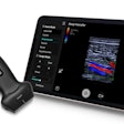 Mindray's TE Air e5M ultrasound system.