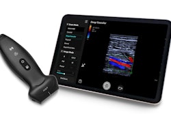 Mindray's TE Air e5M ultrasound system.