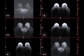 Mri Breast Cancer