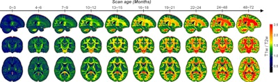 Spatiotemporal maps of T1-weighted to T2-weighted signal intensity ratio (T1w/T2w) during early development (0-6 years). T1-weighted to T2-weighted signal intensity ratio maps were computed by averaging the T1-weighted to T2-weighted signal intensity ratios in all Baby Connectome Project children across discrete age intervals (3-month intervals before 2 years and 2-year intervals thereafter), incorporating both longitudinal and cross-sectional acquisitions. For each age interval, the average map is displayed in sagittal, coronal, and axial views, arranged from top to bottom, respectively. The figure illustrates the characteristic posterior-to-anterior and center-to-periphery myelination gradients. Rapid maturation of deep central structures and major white matter tracts is evident within the first 2 years, followed by more protracted development of association pathways. Warm colors denote higher T1-weighted to T2-weighted ratios, suggestive of more advanced myelination.