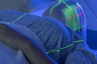 Radiation Therapy Planning 400 (1)