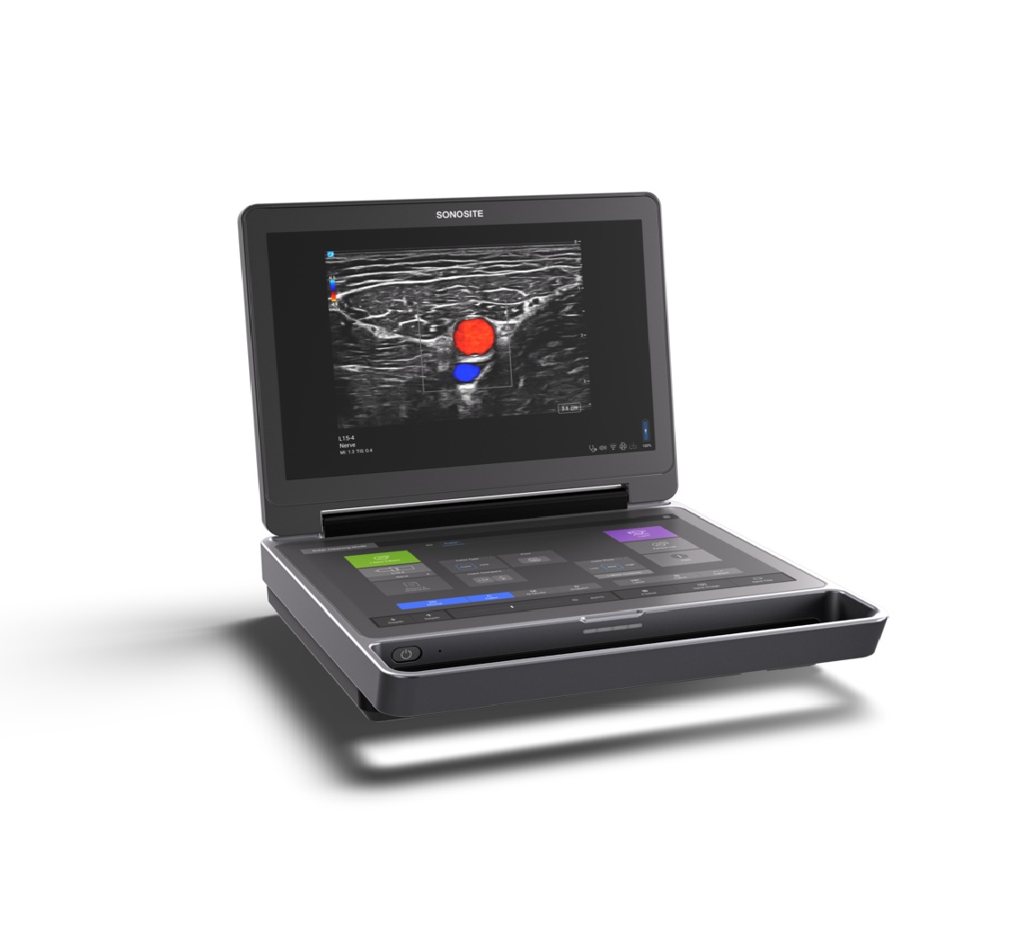 Fujifilm Sonosite's latest portable ultrasound system.