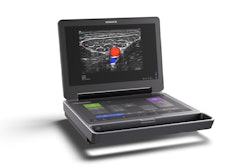 Fujifilm Sonosite's latest portable ultrasound system.