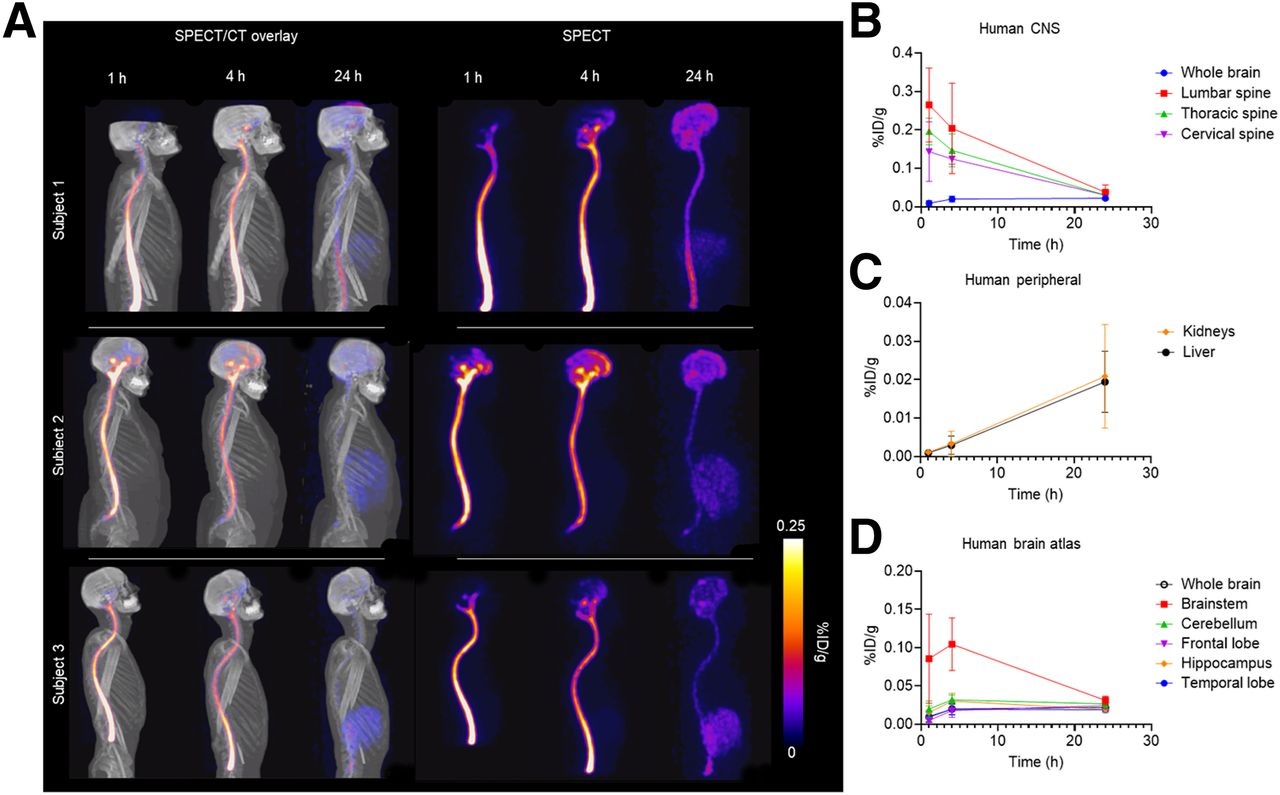 SPECT imaging of Tc-99m MAG3-tofersen in healthy human volunteers. (A) Maximum-intensity-projection images showing distribution of Tc-99m MAG3-tofersen in humans (n = 3) one, four, and 24 hours after intrathecal injection. Time&ndash;activity curves derived from SPECT data measuring activity in ROIs in CNS (lumbar, thoracic, and cervical spine ROIs include both cord and proximal CSF) (B), kidneys and liver (C), and brain atlas (D).