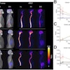 SPECT imaging of Tc-99m MAG3-tofersen in healthy human volunteers. (A) Maximum-intensity-projection images showing distribution of Tc-99m MAG3-tofersen in humans (n = 3) one, four, and 24 hours after intrathecal injection. Time–activity curves derived from SPECT data measuring activity in ROIs in CNS (lumbar, thoracic, and cervical spine ROIs include both cord and proximal CSF) (B), kidneys and liver (C), and brain atlas (D).