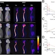 SPECT imaging of Tc-99m MAG3-tofersen in healthy human volunteers. (A) Maximum-intensity-projection images showing distribution of Tc-99m MAG3-tofersen in humans (n = 3) one, four, and 24 hours after intrathecal injection. Time–activity curves derived from SPECT data measuring activity in ROIs in CNS (lumbar, thoracic, and cervical spine ROIs include both cord and proximal CSF) (B), kidneys and liver (C), and brain atlas (D).