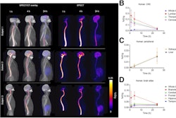 SPECT imaging of Tc-99m MAG3-tofersen in healthy human volunteers. (A) Maximum-intensity-projection images showing distribution of Tc-99m MAG3-tofersen in humans (n = 3) one, four, and 24 hours after intrathecal injection. Time–activity curves derived from SPECT data measuring activity in ROIs in CNS (lumbar, thoracic, and cervical spine ROIs include both cord and proximal CSF) (B), kidneys and liver (C), and brain atlas (D).