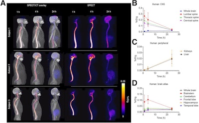 SPECT imaging of Tc-99m MAG3-tofersen in healthy human volunteers. (A) Maximum-intensity-projection images showing distribution of Tc-99m MAG3-tofersen in humans (n = 3) one, four, and 24 hours after intrathecal injection. Time–activity curves derived from SPECT data measuring activity in ROIs in CNS (lumbar, thoracic, and cervical spine ROIs include both cord and proximal CSF) (B), kidneys and liver (C), and brain atlas (D).