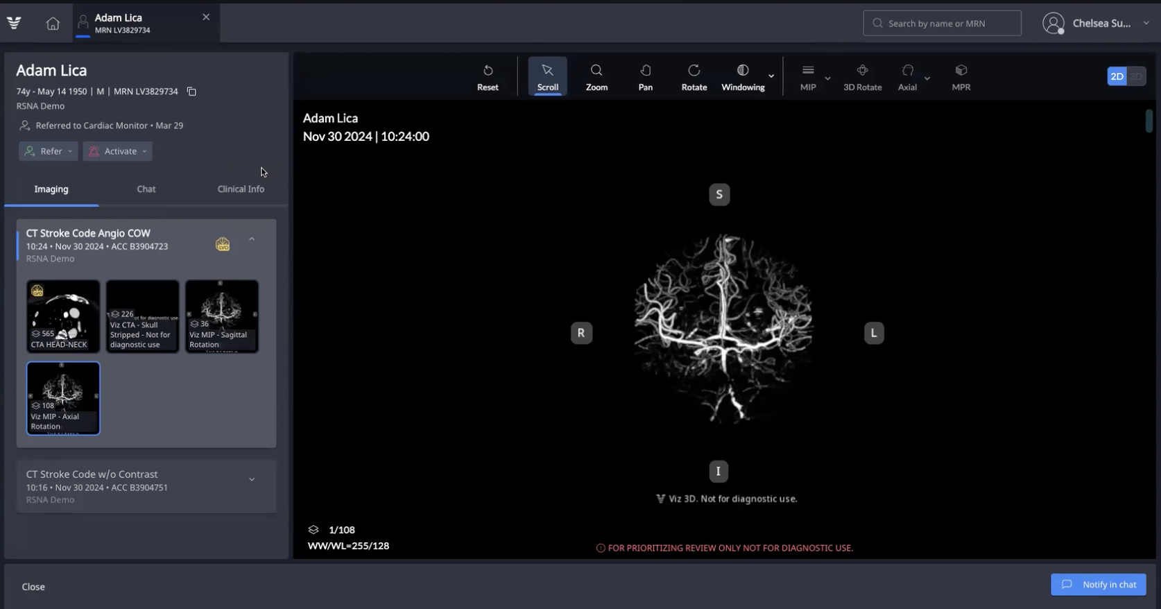 Viz 3D CTA automatically converts CT angiography scans into high-resolution AI-enhanced 3D images.