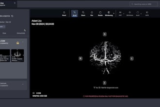 Viz 3D CTA automatically converts CT angiography scans into high-resolution AI-enhanced 3D images.