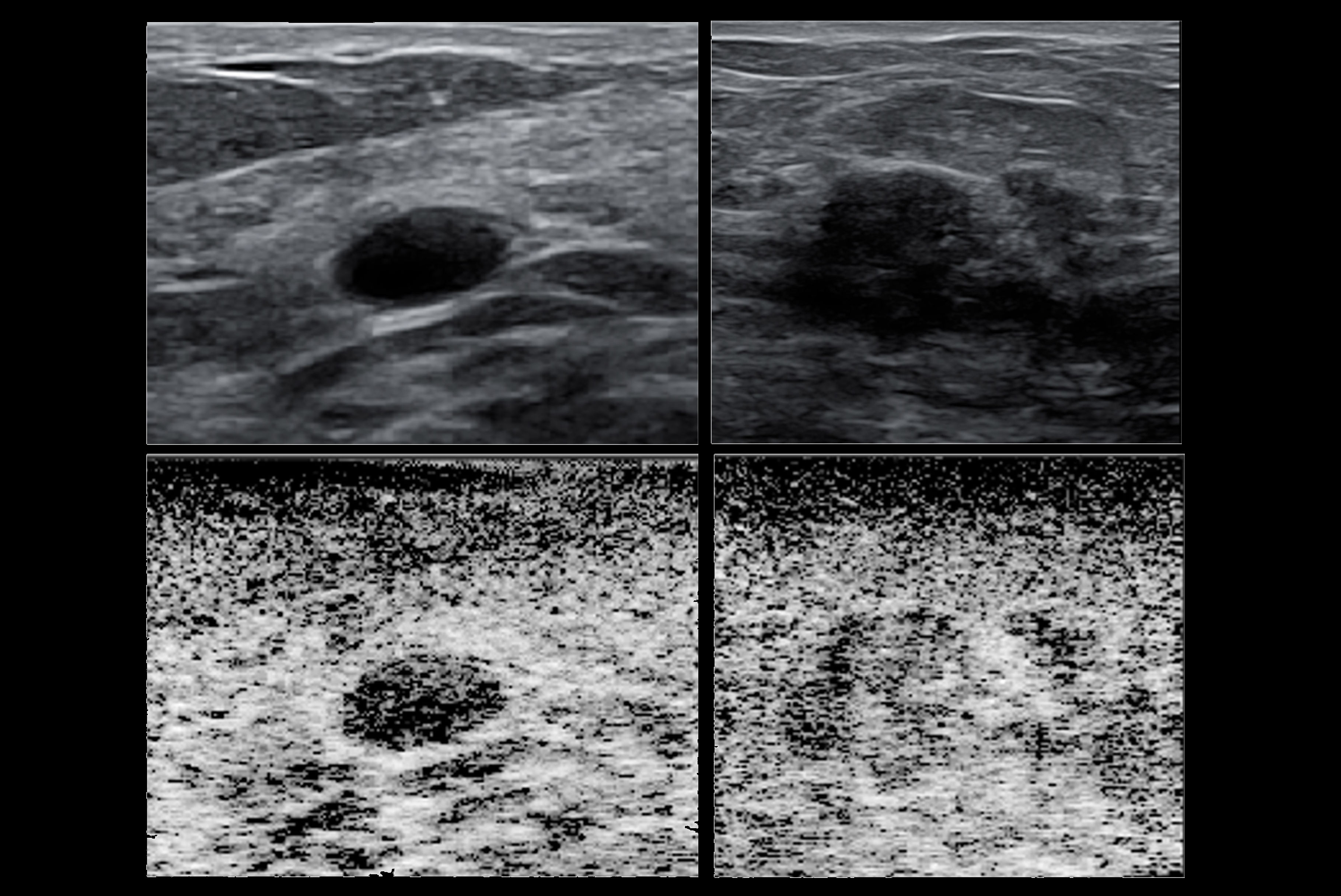2025 12 02 Media Release Graphic New Tech In Breast Ultrasounds Thumbnail