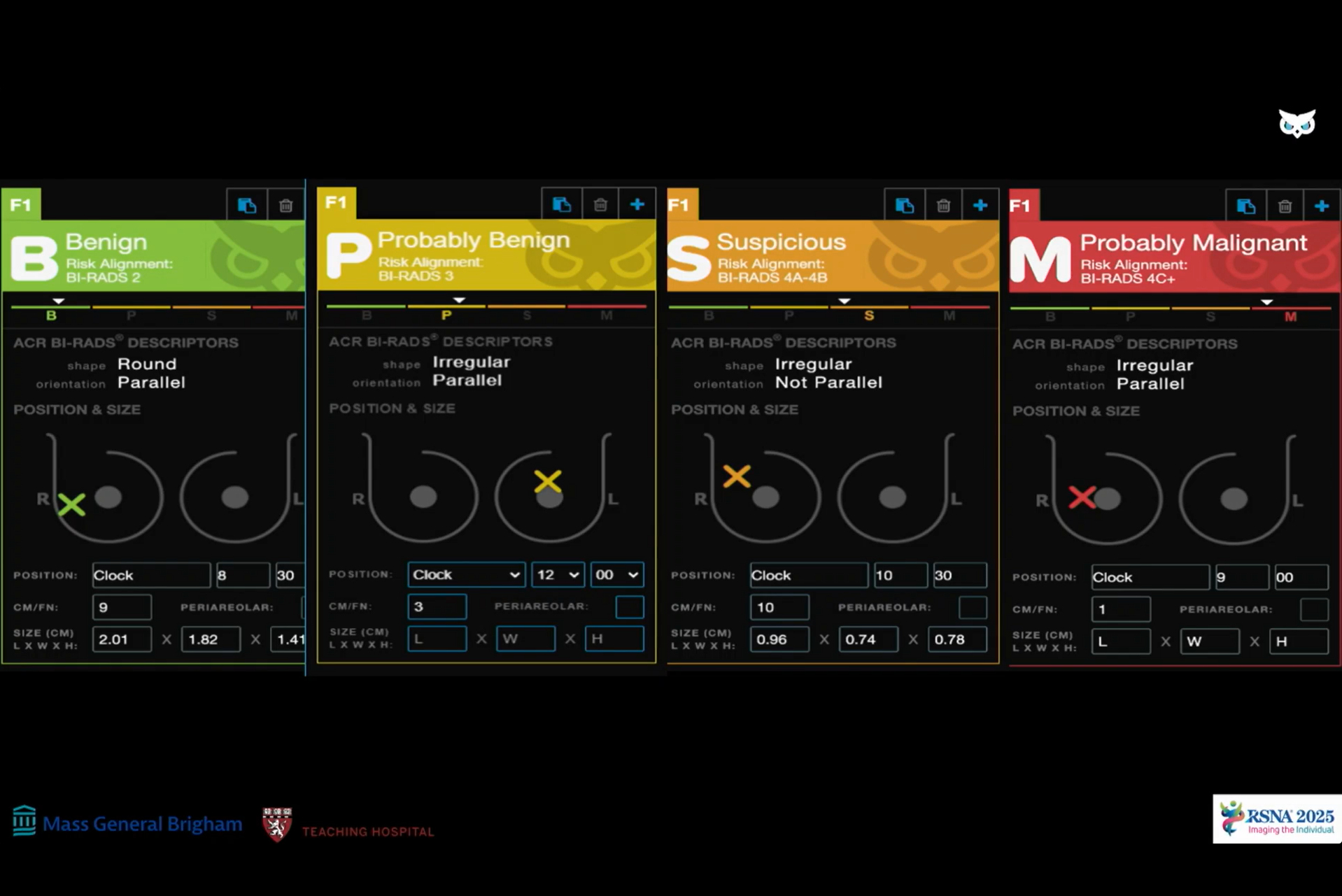 2025 12 05 Ai Decision Support Tool Ultrasound Thumbnail