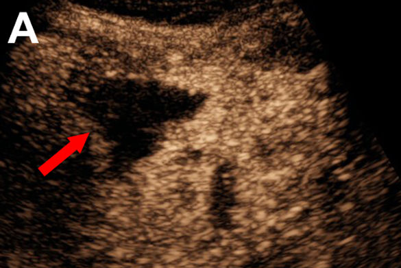 2025 12 16 Radiology Ceus Liver Mri Thumbnail