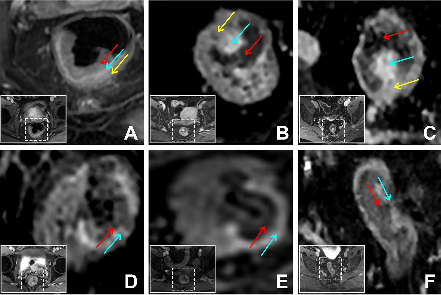 2025 12 23 Dark Light Dark Sign Thumbnail
