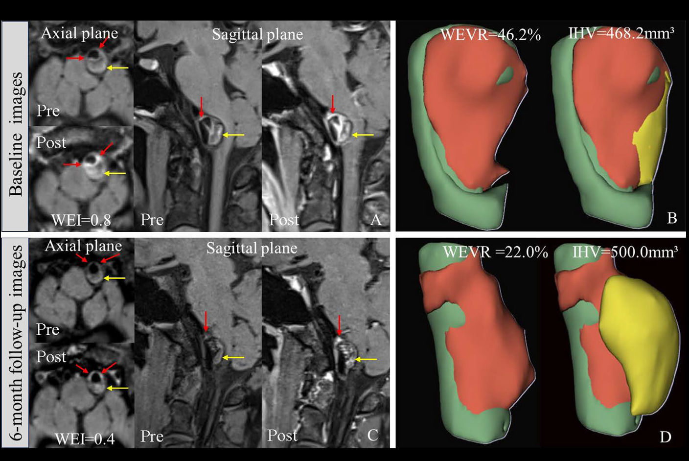 2025 12 23 Radiology Zhang Figure5 Thumbnail