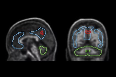 Ad Voxels Thumbnail b Jp7i P0r Gf