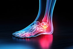 Neuropathy Foot Ulcers Diabetic Adobe Pisahouse