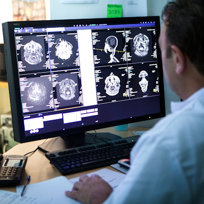 Radiologist Brain Scans Monitor 400