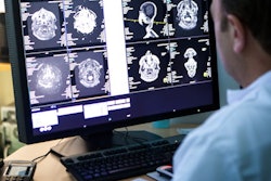 Radiologist Brain Scans Monitor 400