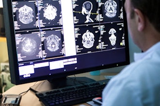 Radiologist Brain Scans Monitor 400