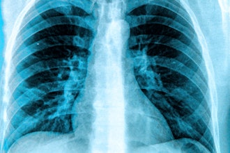 X Ray Chest Lungs