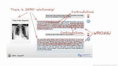 At RSNA 2025, Woojin Kim, MD, illustrated the 'utter nonsense' of a GPT model.