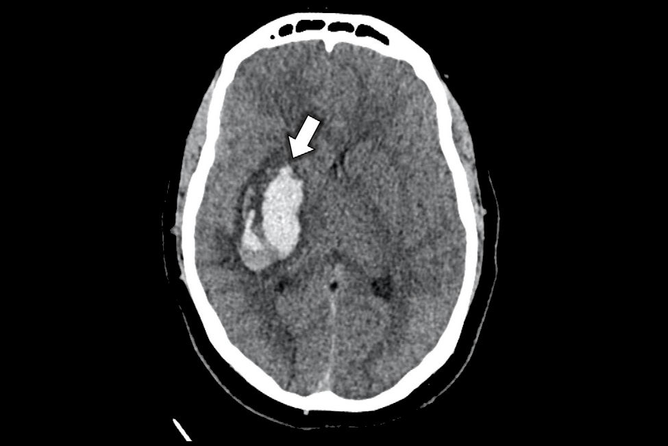 2026 01 08 Radio Graphics Defreitas Figure2 Thumbnail