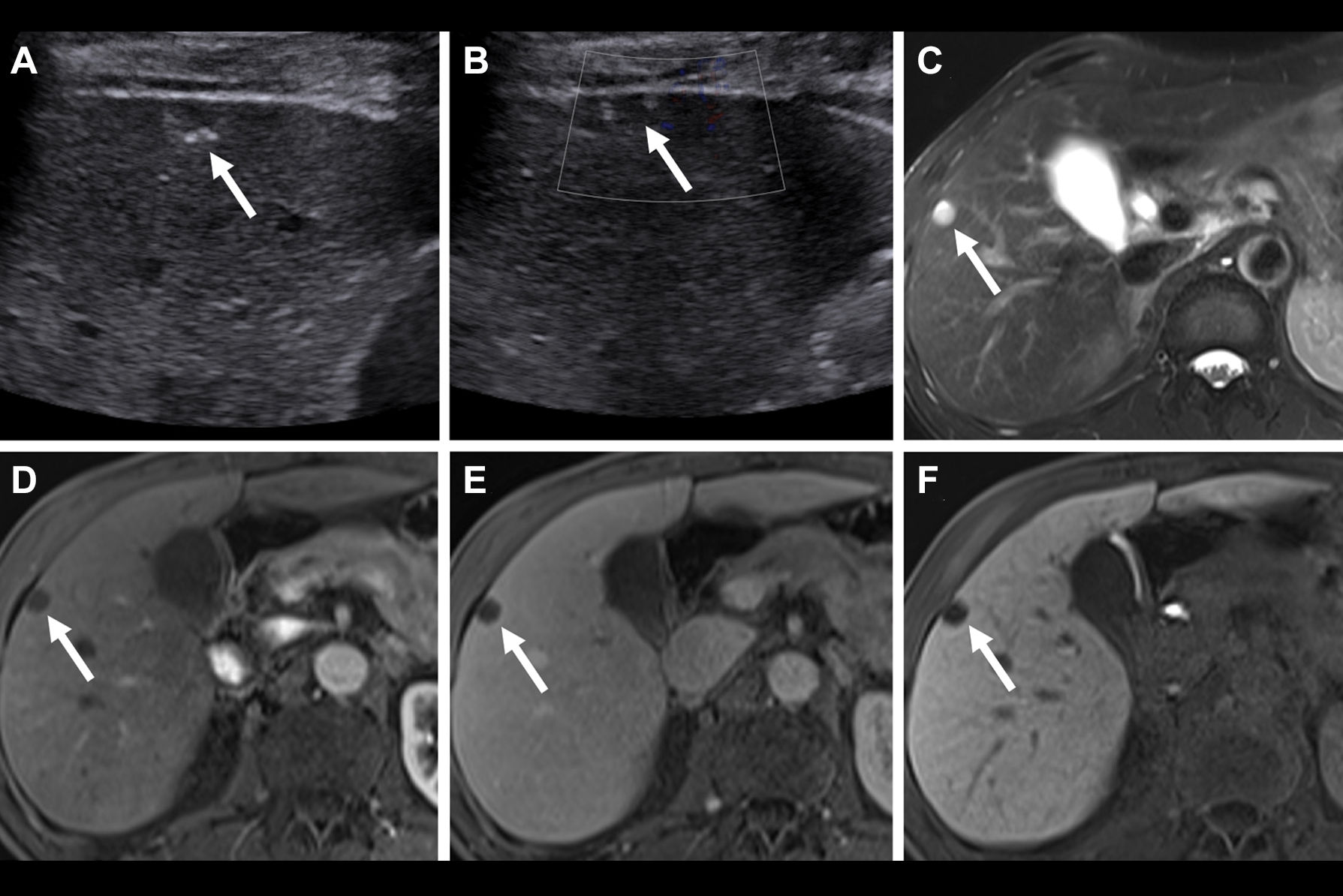 2026 01 20 Radiology Cheng Liver Ultrasound Thumbnail