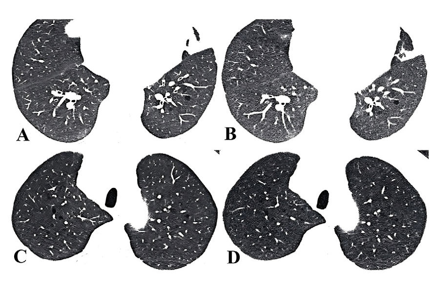 2026 01 20 Radiology Yuan Figure3 A D Thumbnail