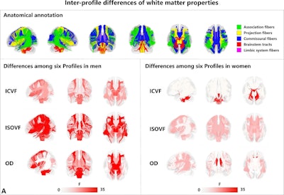 Group comparisons reveal differences across the six profiles in (A) brain white matter properties, (B) subcortical volume, and (C) cortical volume. (A) Five types of white matter fibers in the brain are shown (top). Sex-specific analysis shows differences among the six profiles in neurite orientation dispersion and density imaging (NODDI) measurements of intracellular volume fraction (ICVF), isotropic or free water volume fraction (ISOVF), and orientation dispersion index (OD), presented separately for male participants (bottom left) and female participants (bottom right). (Fig 3 continues below.)