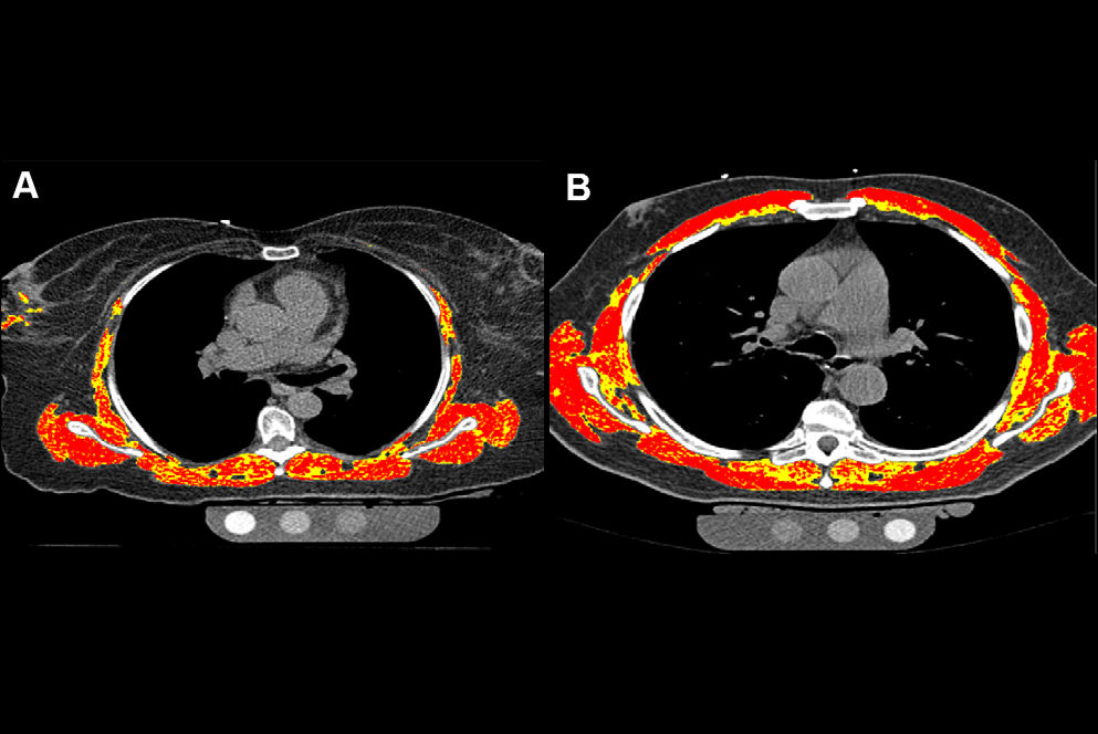 2026 01 29 Rad Cardiothor Azimi Figure5 Thumbnail