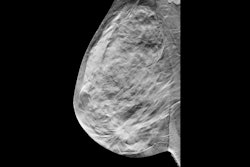 Breast Tomosynthesis Digital Social