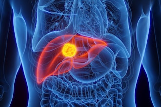 Liver Cancer