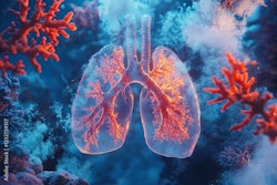 Lung Cancer