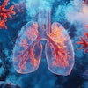 Lung Cancer