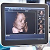 Ultrasound 3 D Fetal Head 400 (1)