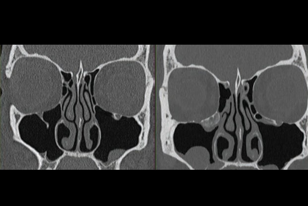 2026 02 04 Ajr Mc Collough Figure Thumbnail