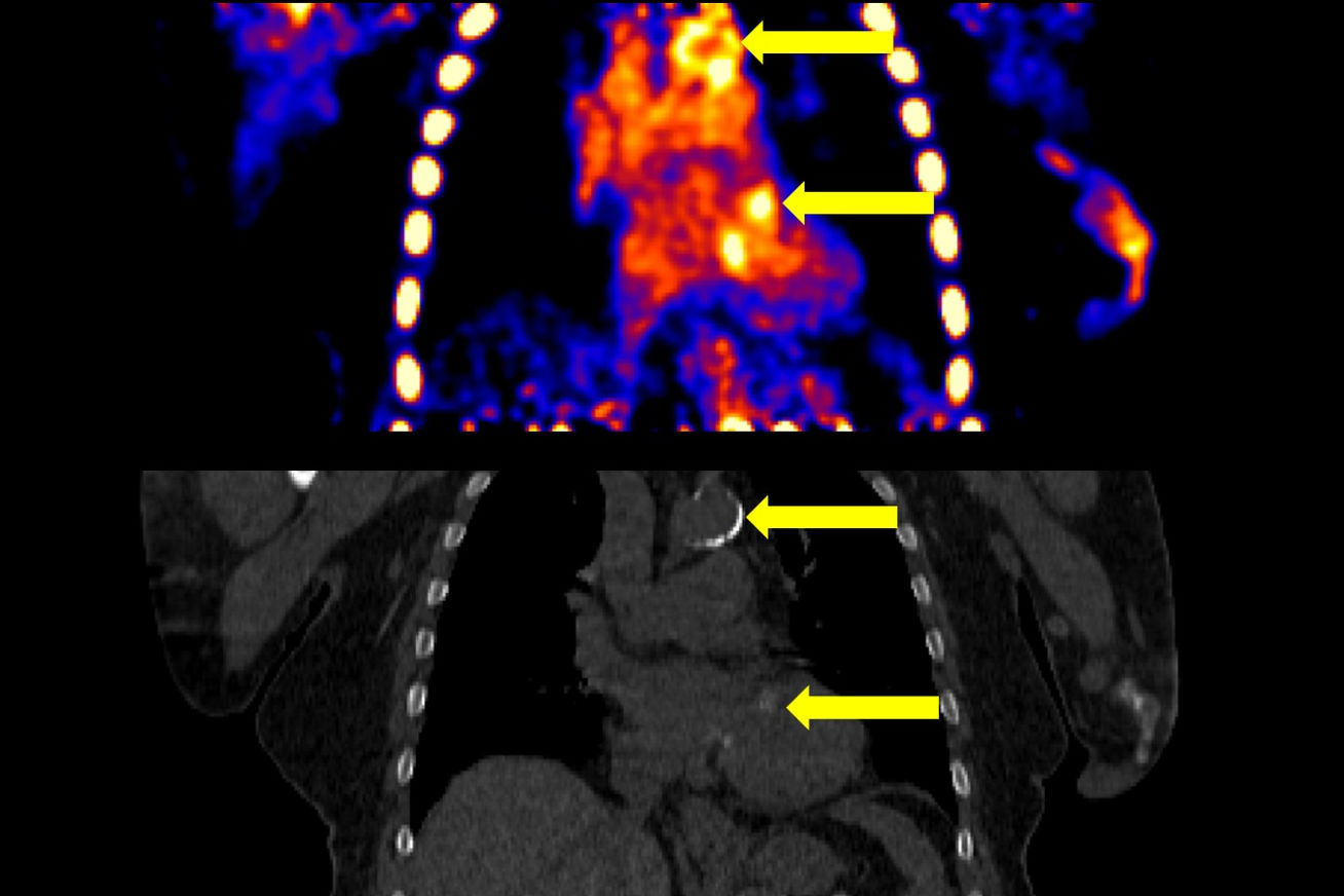 2026 02 09 Pet Calcification Thumbnail