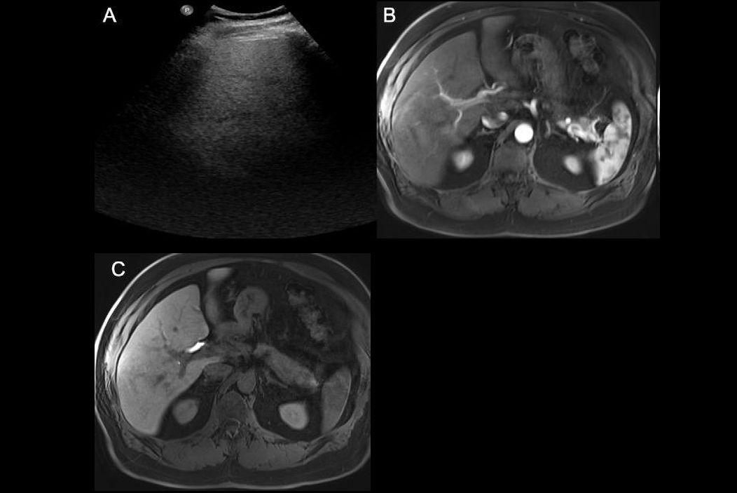 2026 02 10 Radiology Lewis Figure2 Thumbnail