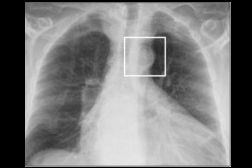 2026 02 12 Chest Ac2 Thumbnail