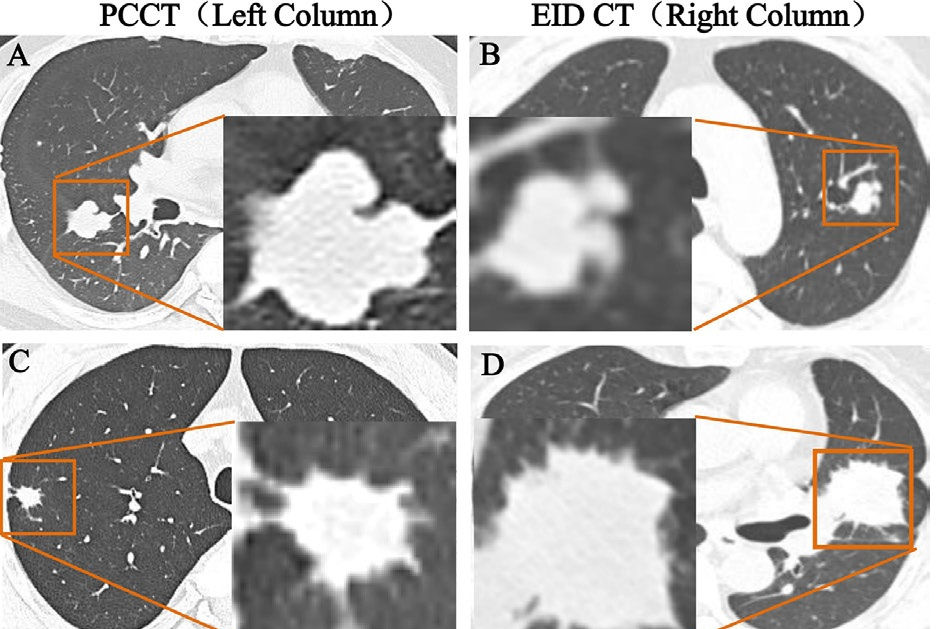 2026 02 17 Quadruple Low Pcct Thumbnail