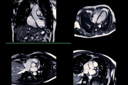 Cardiac Mri Adobe Samunella
