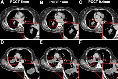 Pcc Approach Radiography Virtus Healthcare
