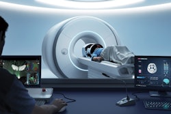 Exablate Prime, Insightec’s MR-guided focused ultrasound system.