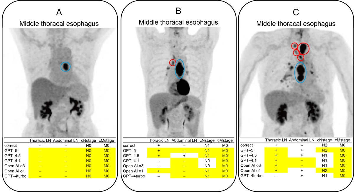 Physicians superior to LLMs in interpreting PET imaging | AuntMinnie