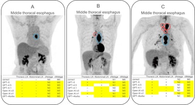 Physicians superior to LLMs in interpreting PET imaging