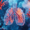 Lung Cancer