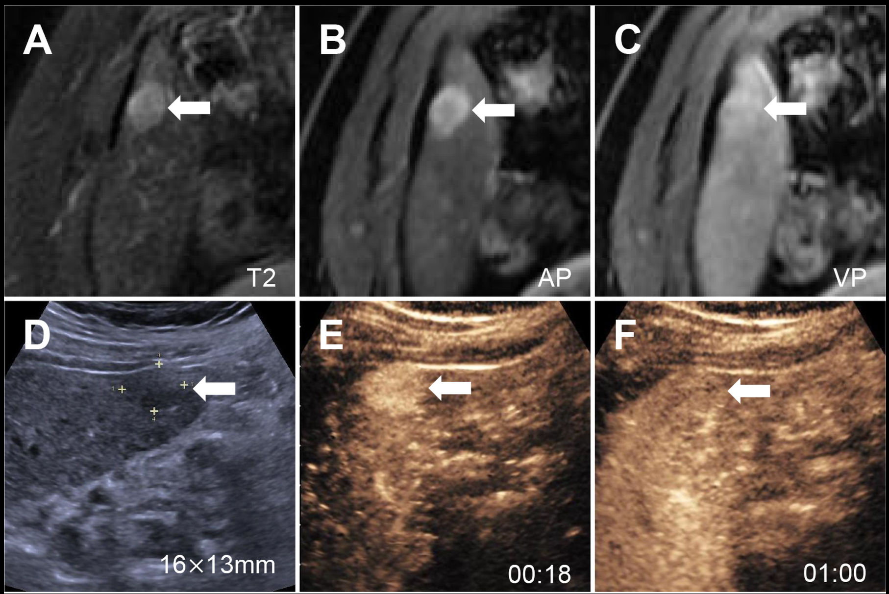 2026 03 03 Radiology Ceus Liver Thumbnail
