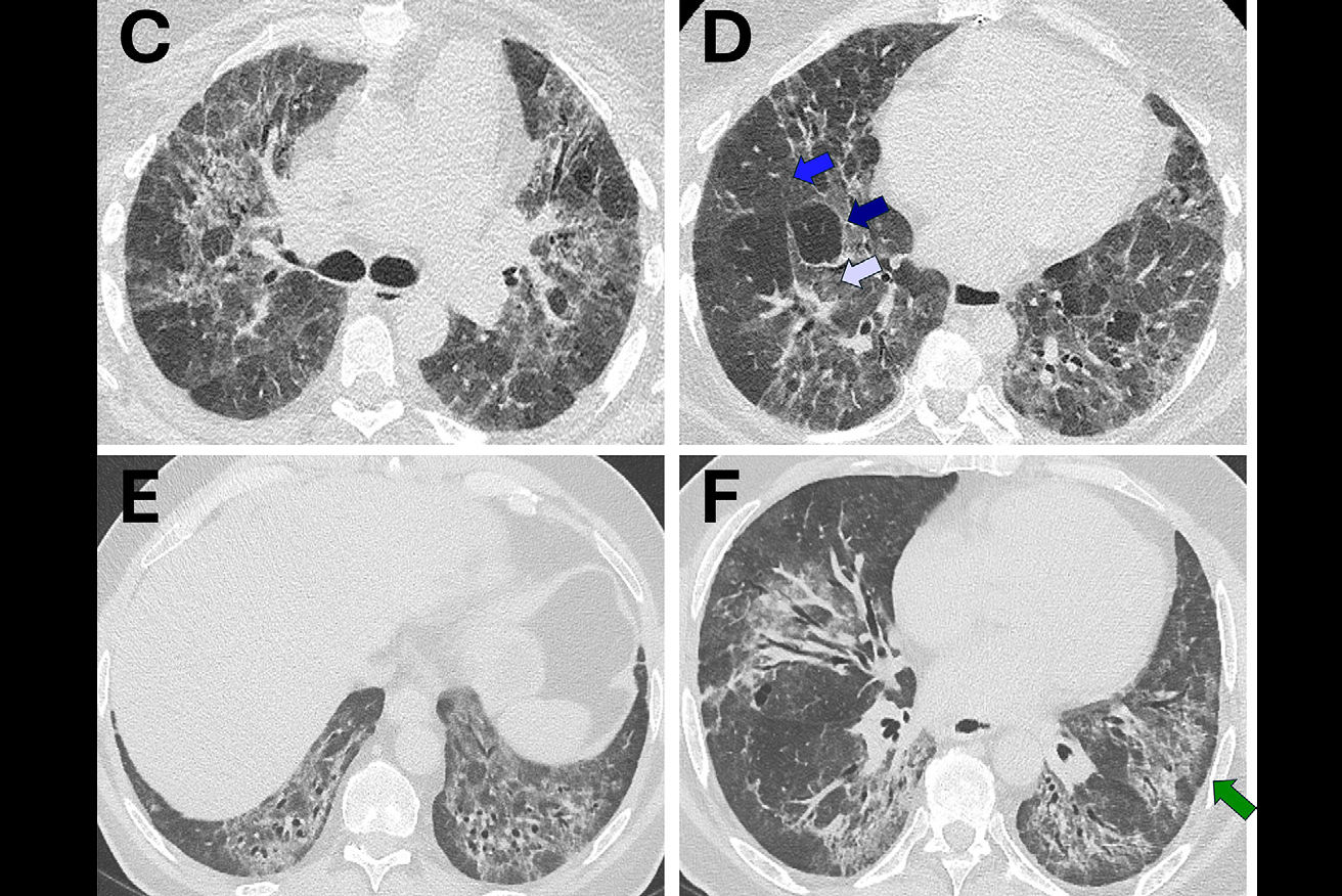 2026 03 17 Marinescu Image Thumbnail