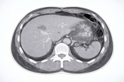 Abdominal Ct Adobe Chubby Kt
